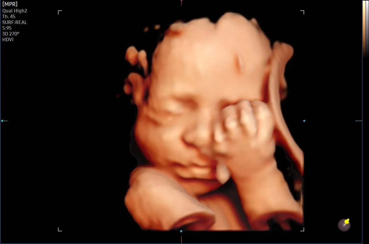 4D ultrasonda elini yüzüne götüren bebek