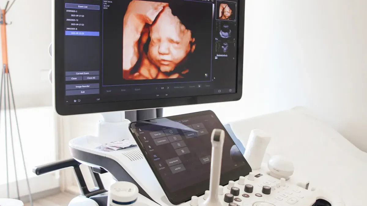Rahim içi kan akımı doppler ultrason cihazı