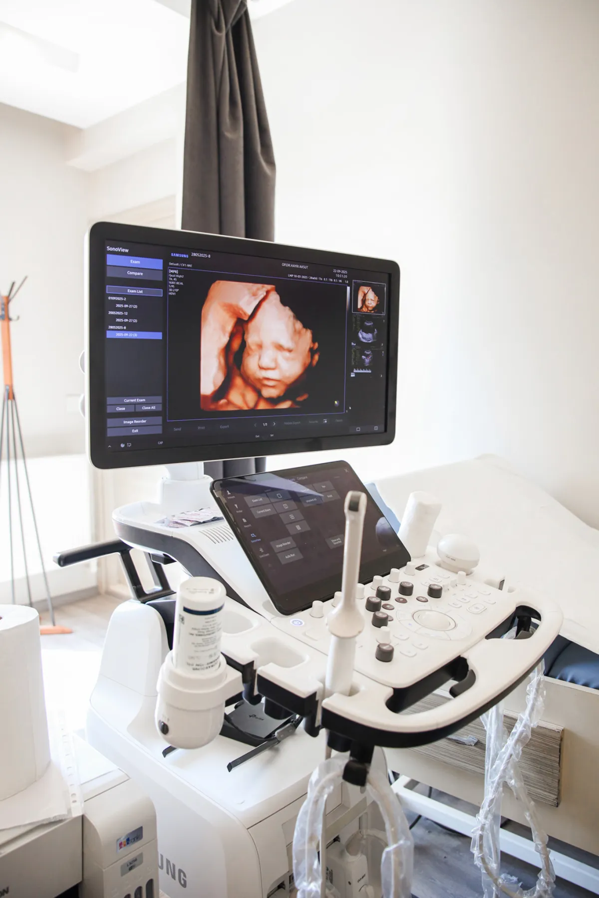 Klinikteki 3D/4D gebelik ultrason cihazı